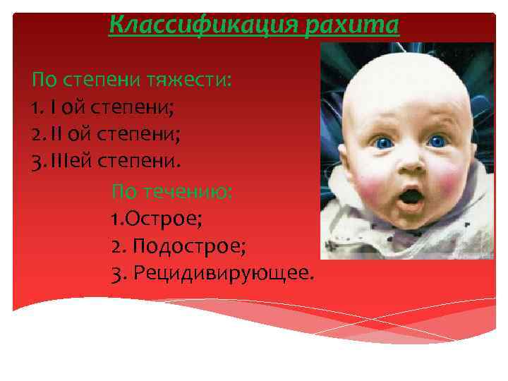 Классификация рахита По степени тяжести: 1. I ой степени; 2. II ой степени; 3.