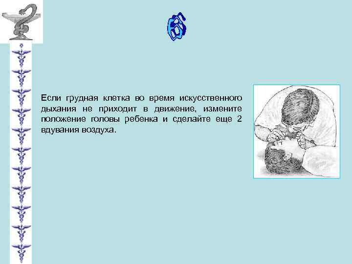 Если грудная клетка во время искусственного дыхания не приходит в движение, измените положение головы