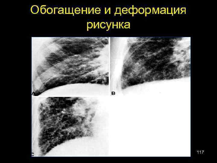 Обогащение и деформация рисунка 117 