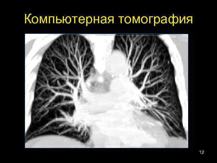 Компьютерная томография 12 