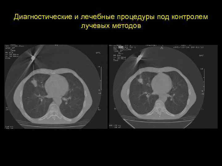Диагностические и лечебные процедуры под контролем лучевых методов 