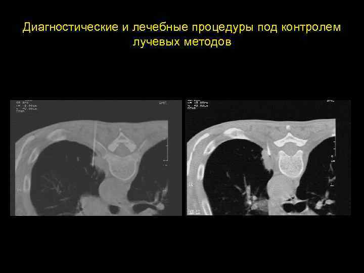 Диагностические и лечебные процедуры под контролем лучевых методов 