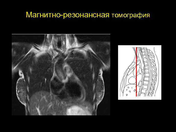 Магнитно-резонансная томография 