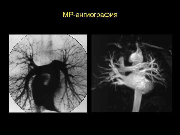 МР-ангиография 