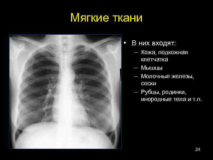 Мягкие ткани • В них входят: – Кожа, подкожная клетчатка – Мышцы – Молочные