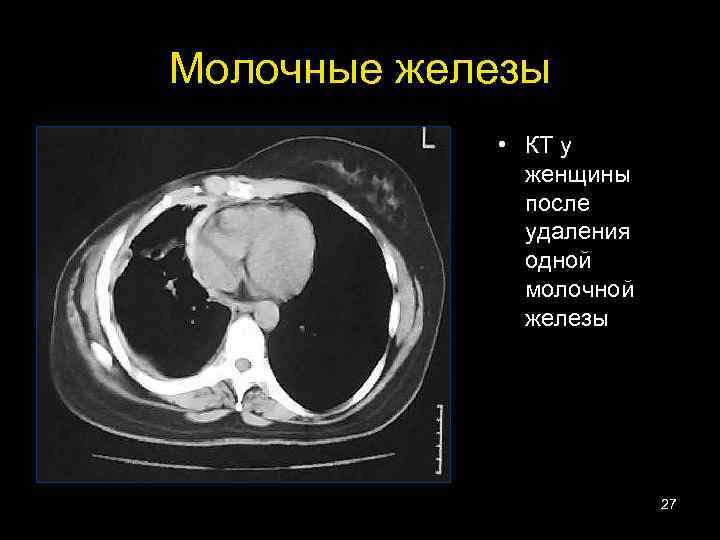 Молочные железы женщины фото