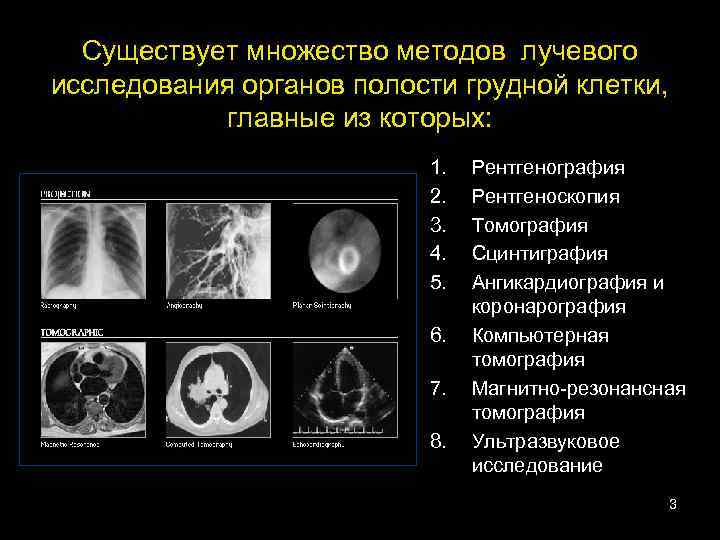 Лучевая диагностика органов дыхания презентация