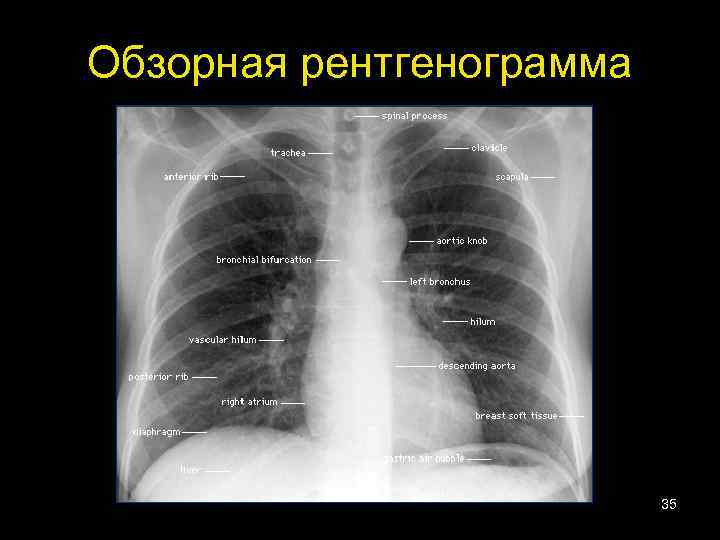 Лучевая диагностика органов дыхания презентация