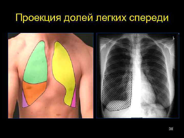 Проекция долей легких спереди 38 