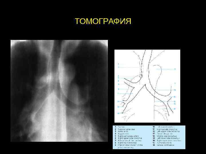 ТОМОГРАФИЯ 