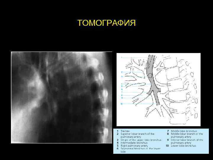 ТОМОГРАФИЯ 