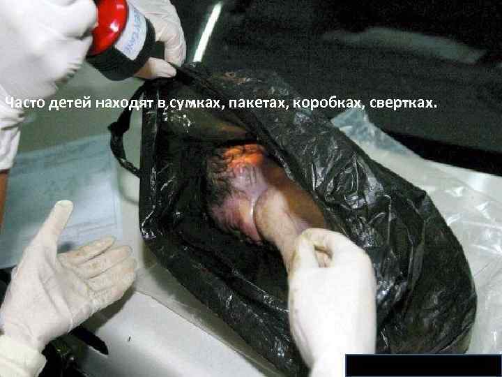 Часто детей находят в сумках, пакетах, коробках, свертках. 