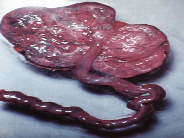 Наружное исследование трупа 