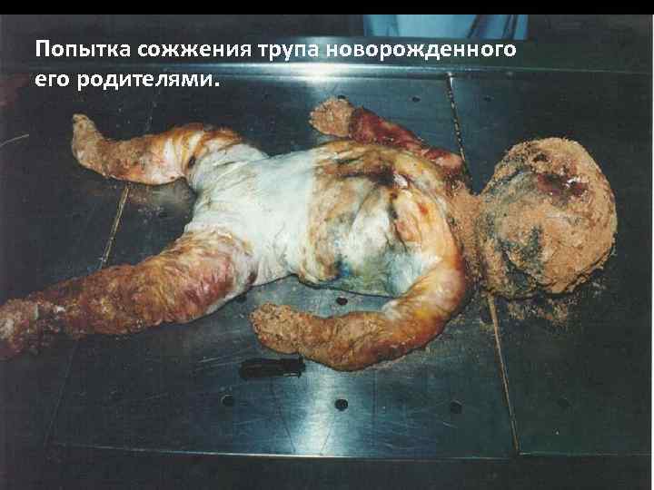 Попытка сожжения трупа новорожденного его родителями. 