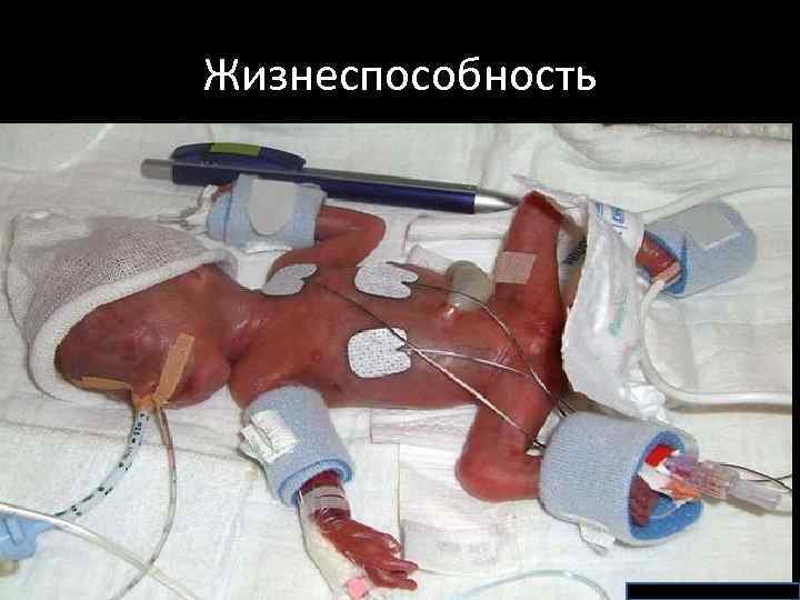 Жизнеспособность • Жизнеспособность – способность ребенка к жизни вне организма матери. • Длина тела