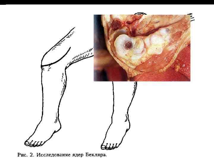 Зрелость, доношенность: Беременность продолжается в среднем 280 дней. Доношенным считается младенец, родившийся после 38