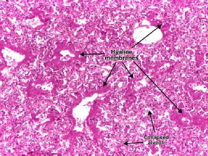 Живорожденность • Живорожденность - это полное изгнание или извлечение продукта зачатия из организма матери
