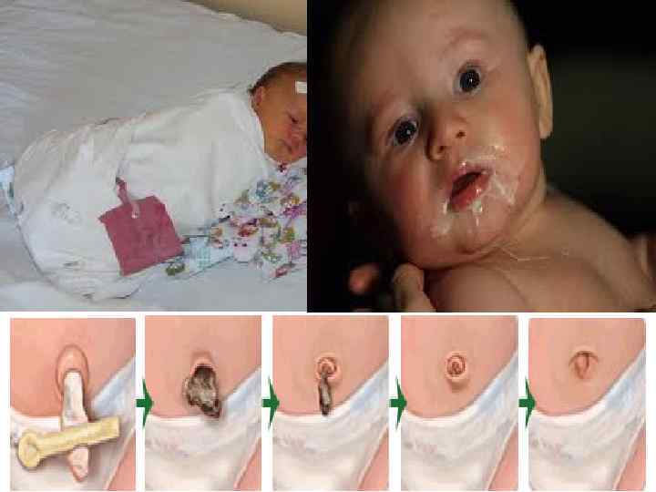 Определение ухода за ребенком. • определение рождения ребенка в БОЛЬНИЧНЫХ условиях. • определение МЕДИЦИНСКОГО