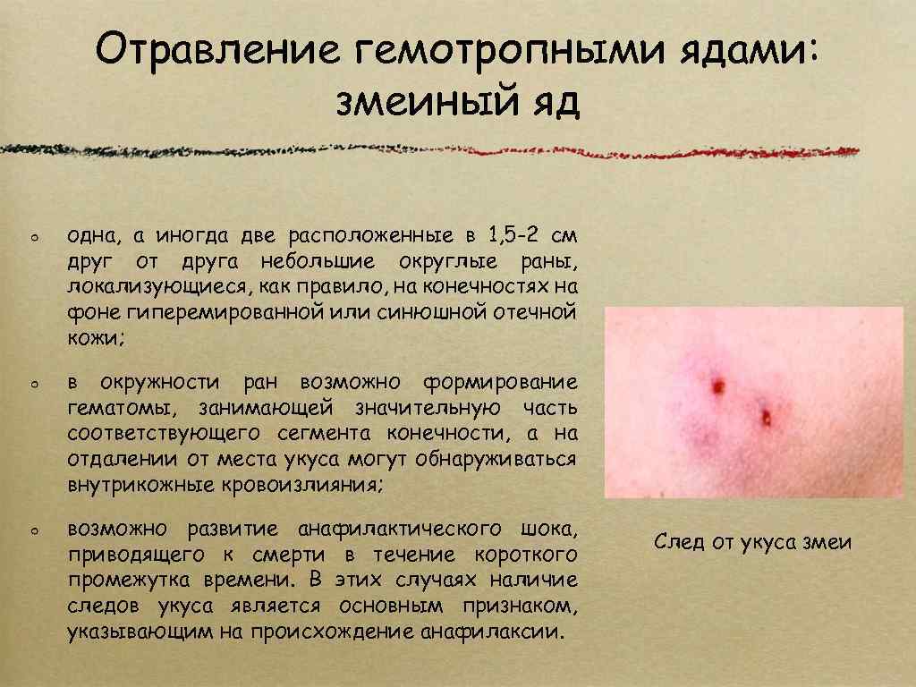 Отравление гемотропными ядами: змеиный яд одна, а иногда две расположенные в 1, 5 -2