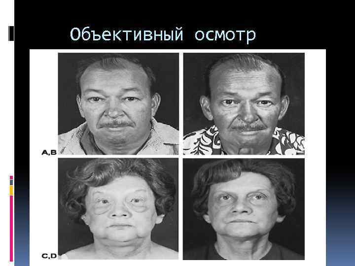  Объективный осмотр 