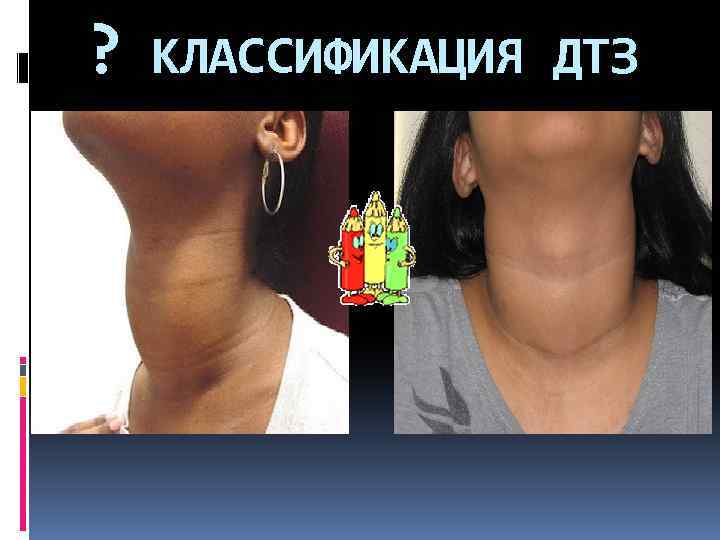 ? КЛАССИФИКАЦИЯ ДТЗ 