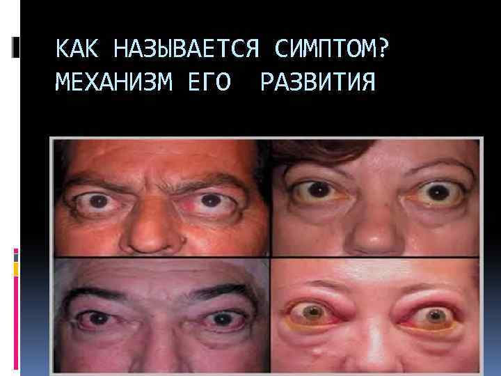 КАК НАЗЫВАЕТСЯ СИМПТОМ? МЕХАНИЗМ ЕГО РАЗВИТИЯ 