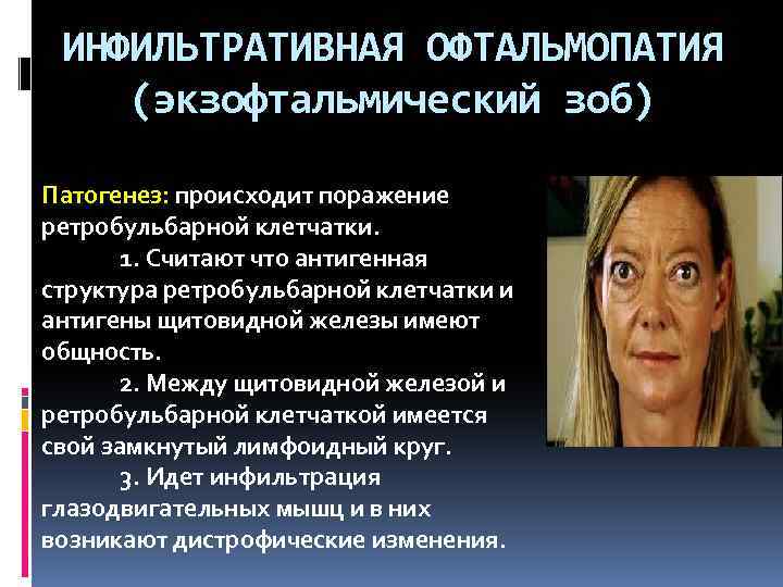 ИНФИЛЬТРАТИВНАЯ ОФТАЛЬМОПАТИЯ (экзофтальмический зоб) Патогенез: происходит поражение ретробульбарной клетчатки. 1. Считают что антигенная структура
