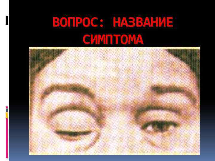 ВОПРОС: НАЗВАНИЕ СИМПТОМА 