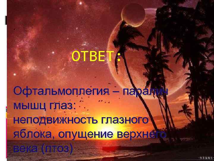 ОТВЕТ: Офтальмоплегия – паралич мышц глаз: неподвижность глазного яблока, опущение верхнего века (птоз) 
