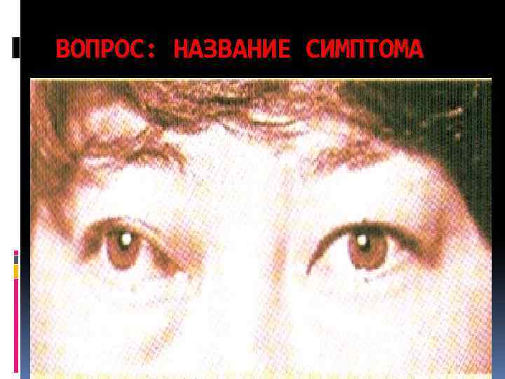 ВОПРОС: НАЗВАНИЕ СИМПТОМА 