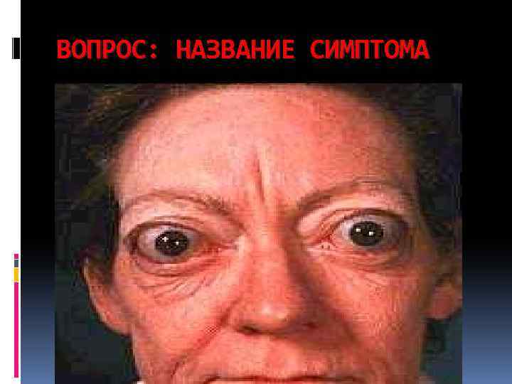 ВОПРОС: НАЗВАНИЕ СИМПТОМА 