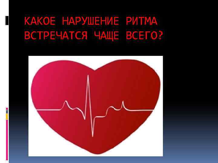 КАКОЕ НАРУШЕНИЕ РИТМА ВСТРЕЧАТСЯ ЧАЩЕ ВСЕГО? 