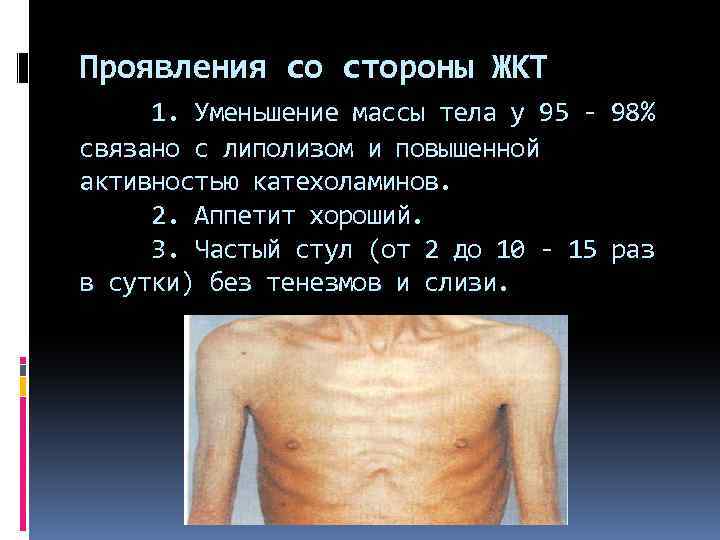 Проявления со стороны ЖКТ 1. Уменьшение массы тела у 95 - 98% связано с