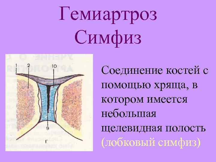 Гемиартроз Симфиз Соединение костей с помощью хряща, в котором имеется небольшая щелевидная полость (лобковый