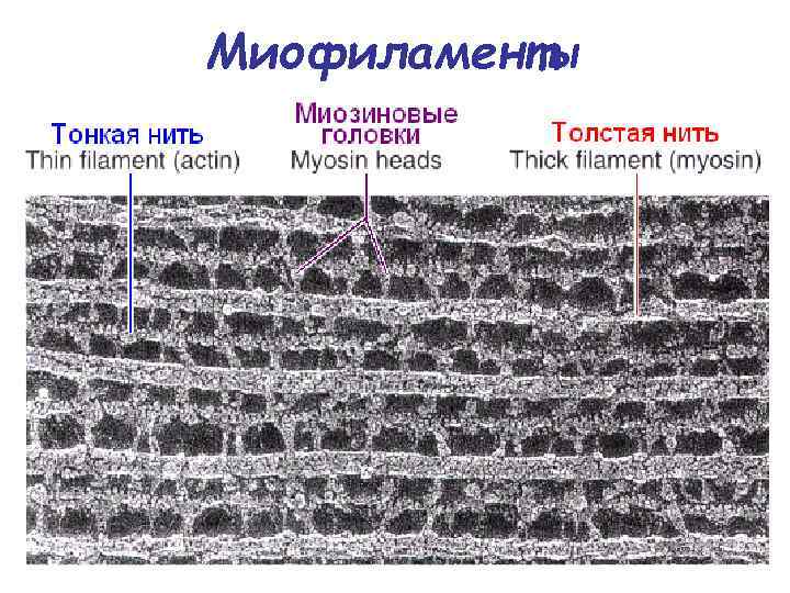 Миофиламенты 