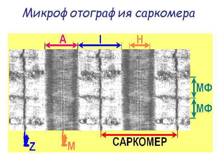 Микрофотография саркомера 