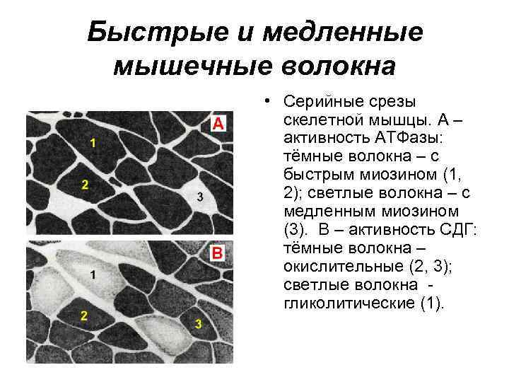 Быстрые и медленные мышечные волокна • Серийные срезы скелетной мышцы. А – активность АТФазы: