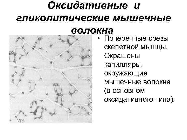 Оксидативные и гликолитические мышечные волокна • Поперечные срезы скелетной мышцы. Окрашены капилляры, окружающие мышечные