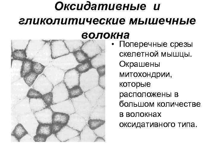 Оксидативные и гликолитические мышечные волокна • Поперечные срезы скелетной мышцы. Окрашены митохондрии, которые расположены