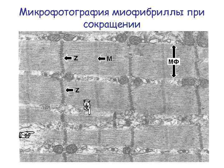 Микрофотография миофибриллы при сокращении 