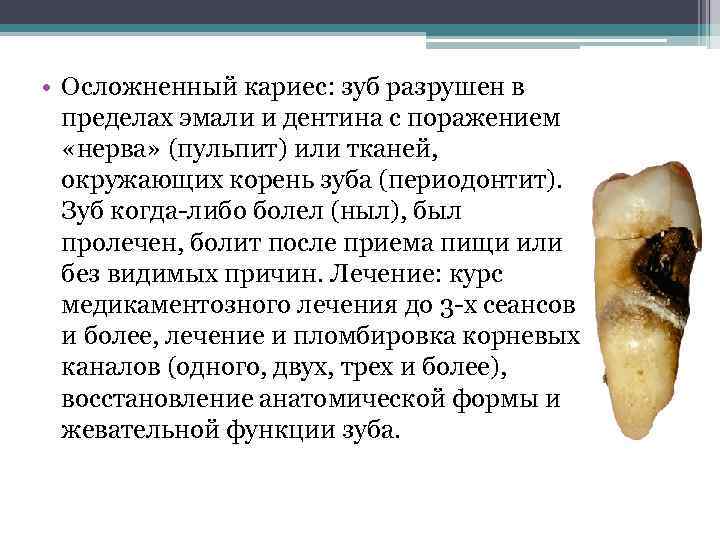  • Осложненный кариес: зуб разрушен в пределах эмали и дентина с поражением «нерва»