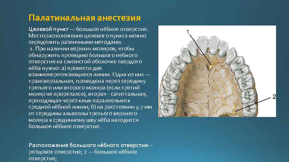 Местная анестезия картинки