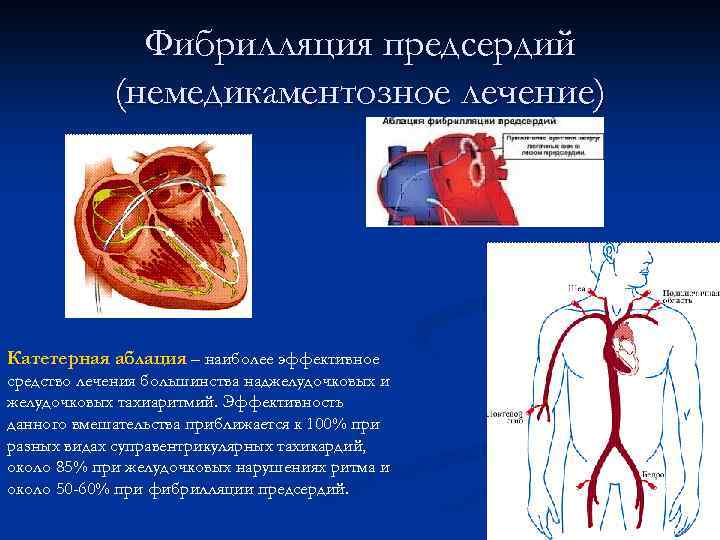 Уровень сердца