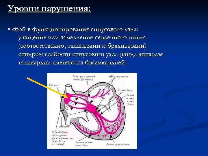 Уровни нарушения: • сбой в функционирования синусового узла: учащение или замедление сердечного ритма (соответственно,