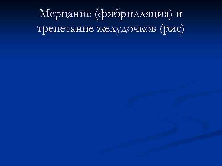 Мерцание (фибрилляция) и трепетание желудочков (рис) 