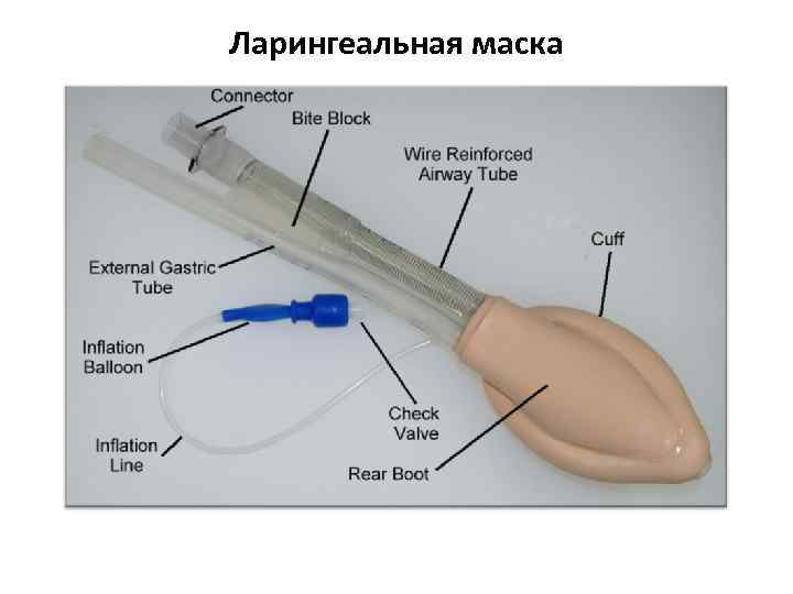 Ларингеальная маска. Введение ларингеальной маски алгоритм. Ларингиальная маска вид с боку. Устройство ларингеальной маски. Ларингеальная маска техника постановки.