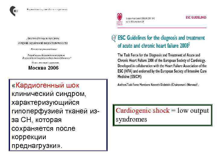  «Кардиогенный шок клинический синдром, характеризующийся гипоперфузией тканей из за СН, которая сохраняется после