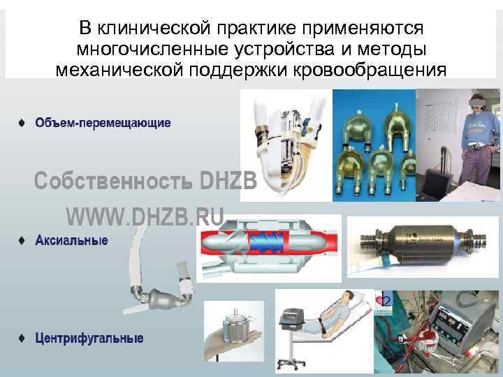 В клинической практике применяются многочисленные устройства и методы механической поддержки кровообращения 