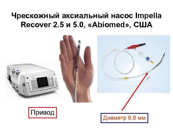 Чрескожный аксиальный насос Impella Recover 2. 5 и 5. 0, «Abiomed» , США Привод