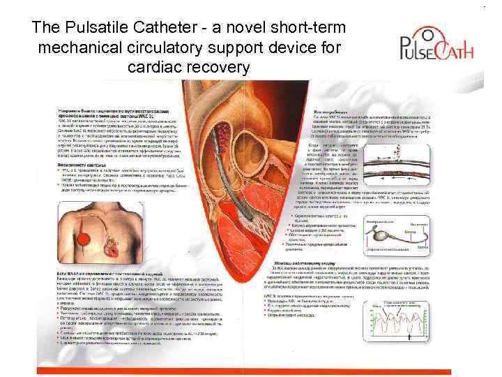 The Pulsatile Catheter a novel short term mechanical circulatory support device for cardiac recovery